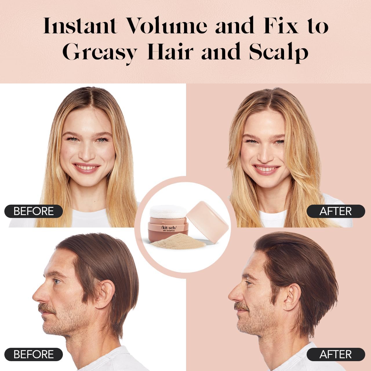 Kitsch Dry Shampoo Powder with Rice Protein for Women & Men