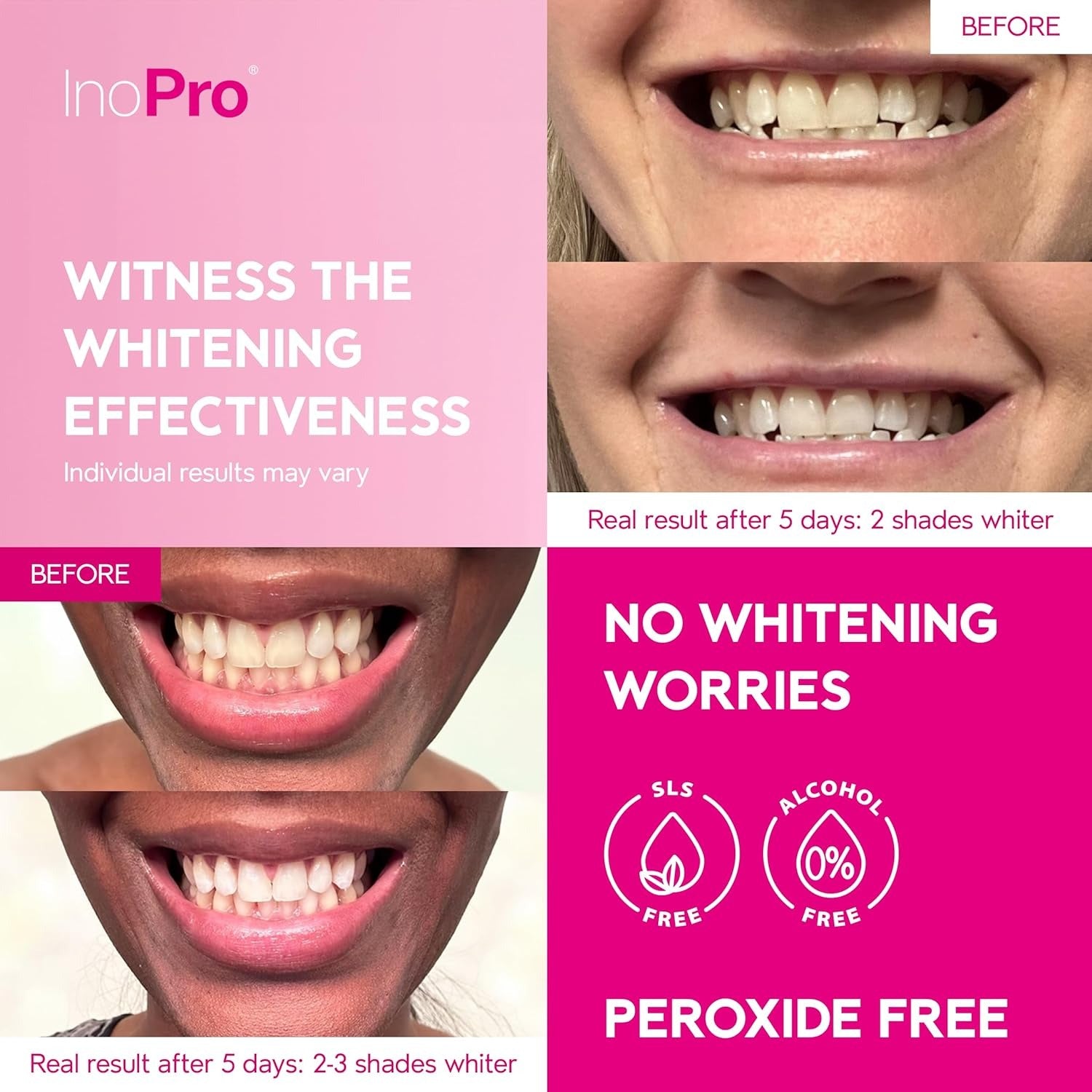 Teeth Whitening Strips 14 Treatments Kit - Teeth Whitener, Peroxide Free